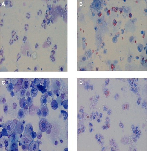 Figure 1 Airway inflammation phenotypes present in sputum from asthma and COPD patients.