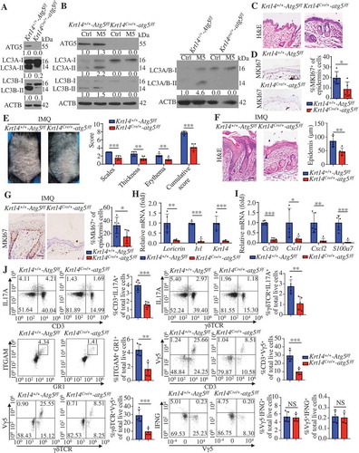 Figure 3. Keratinocyte-speciﬁc ablation of autophagy caused resistance to IMQ-induced psoriasis. (A) Representative immunoblots of the indicated autophagy markers from epidermal lysates of Krt14+/+-Atg5f/f and Krt14Cre/+-atg5f/f mice. (B) Representative western blots for the indicated autophagy markers in Krt14+/+-Atg5f/f and Krt14Cre/+-atg5f/f primary murine keratinocytes stimulated with or without M5 for 48 h. (C) Representative images of the dorsal back from Krt14+/+-Atg5f/f and Krt14Cre/+-atg5f/f mice stained with H&E. Scale bars: 50 μm. n = 5/group. (D) Representative MKI67 immunohistochemistry of the back skin (left), scale bars: 50 μm. MKI67-positive cells were quantified by counting the stained dots (right). n = 5/group. (E-J) The Krt14+/+-Atg5f/f and Krt14Cre/+-atg5f/f mice were treated with IMQ for 5 d, n = 5/group. (E) Representative images of the dorsal back from mice (left) and mice PASI scores were depicted (right). (F) Representative histological sections of the dorsal back from mice stained with H&E (left), and quantification of the epidermal thickness based on epidermal thickness measurements (right), scale bars: 50 μm. Representative immunohistochemistry images of MKI67 in the dorsal back of mice, scale bars: 50 μm (left). (G) Quantification of MKI67-positive cells in the epidermis of the dorsal back (right). (H and I) qRT-PCR analysis of indicated genes from the dorsal skin RNA of mice. (J) Representative and quantiﬁcation of intracellular FACS analysis of IL17-producing cells, neutrophils cells, Vγ5+ cells and IFNG+ cells in dorsal skin. ACTB was detected as a loading control (A and B). Mean ± SD. *P < 0.05; **P < 0.01; ***P < 0.001. Two-tailed Student’s T-test (D-J). All the data are representative of three independent experiments