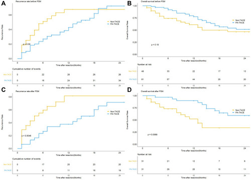 Figure 1 (A) Comparison of recurrence rate between the PA-TACE and non-TACE groups before PSM. (B) Comparison of overall survival rate between the PA-TACE and non-TACE groups before PSM. (C) Comparison of recurrence rate between the PA-TACE and non-TACE groups after PSM. (D) Comparison of overall survival rate between the PA-TACE and non-TACE groups after PSM.