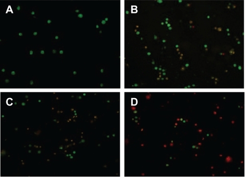 Figure 9 Morphological detections of MCF-7 in different groups by AO/EB double staining. (A) control group, (B) DCT solution, (C) DCT-L, (D) FA-PDCT4000-L.