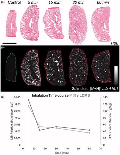 Figure 1. (a) H&E staining of dosed lung sections for morphological evaluation. (b) Distribution of salmeterol at 5, 15, 30, and 60 min after administration via nebulization using MALDI-MSI at 70 µm spatial resolution (duplicate biological replicates). White denotes the maximal signal intensity per image and black the minimal signal intensity observed. (c) Kinetic profile of salmeterol levels with overlay of its relative abundance from MSI (light grey) and its concentration from lung homogenate bioanalysis (dark grey). Intensity scale 0–100% Scale bar = 6 mm.