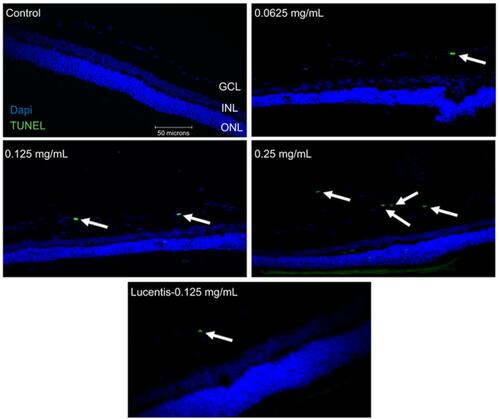 Figure 1 Terminal deoxynucleotidyl transferase dUTP nick end labeling (TUNEL) staining of diabetic rat retina. TUNEL staining performed in streptozotocin (STZ)-induced diabetic rats showed increased apoptotic cells in the ganglion cell layer following different doses of anti-VEGF injections compared with untreated retina from the diabetic control group. Blue represents 4′,6-diamidino-2-phenylindole (DAPI)-stained nuclei and green represents TUNEL staining. Magnification x40. n=5 for each group. Scale bar: 50 µm.