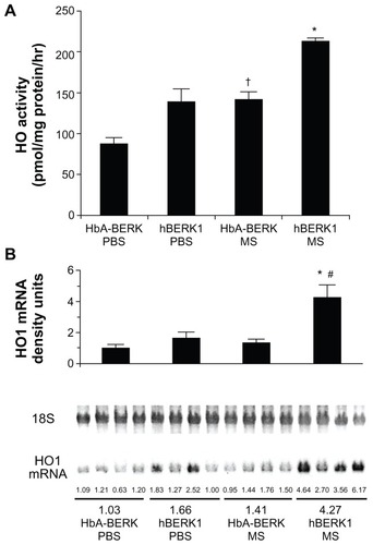Figure 7 Morphine stimulates heme oxygenase (HO) activity and alters kidney function. (A) HO activity in the kidney of HbA-BERK and hBERK1 mice after 3 weeks of morphine treatment. Each bar represents the mean ± SEM of 4 mice/group. *P < 0.001 compared with hBERK1 mice treated with PBS or HbA-BERK mice treated with MS; †P < 0.01 compared with HbA-BERK PBS. (B) HO1 mRNA expression in the kidney of HbA-BERK and hBERK1 mice after 3 weeks of morphine treatment.