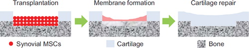 Figure 6. Diagram of the process of cartilage repair. At about 1 month, a membranous layer formed over the defect, and by 3 months cartilage had formed to repair the defect.