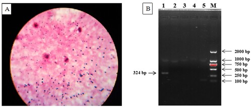 Figure 2. The results of the laboratory analyses. A Gram staining of the contents of the small intestine (20×), showing Gram-positive bacilli, obtusely rounded at both ends, appearing singly or in groups of two or three connected end-to-end. B Agarose gel electrophoresis of the qRT-PCR products amplified from the intestinal contents. Lane #1: C. perfringens alpha toxin, showing an amplification band at 324-bp, consistent with C. perfringens type A. Lane #2: Bovine rotavirus, showing that no DNA was amplified by the qRT-PCR. Lane #3: Bovine coronavirus, showing that no DNA was amplified by the qRT-PCR. Lane #4: Bovine viral diarrhea virus, showing that no DNA was amplified by the qRT-PCR. Lane #5. Bovine adenovirus, showing that no DNA was amplified by the qRT-PCR. Lane M: DNA maker (DL2000).