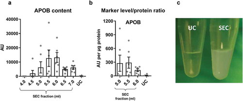 Figure 3. Lipoprotein content in samples of rat blood plasma obtained with SEC or UC.(a): APOB as a marker of lipoproteins measured by DELFIA for SEC fractions 4.0–7.0 ml and UC samples. AU – arbitrary units normalised to volumes in each sample. n = 6. (b): APOB lipoprotein marker signal was normalised to total protein amount for the peak sEV SEC fractions 5.0–6.0 ml as well as for the UC samples. n = 6. (c): UC sample visual appearance compared to pooled and concentrated SEC fractions 3.5–6.0 ml. Note the opaque appearance of the SEC sample indicative of the presence of lipids.