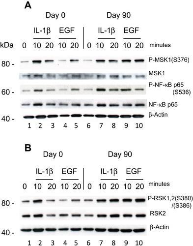 Figure 4 Effect of DMF on PBMCs isolated from psoriatic patient 2 not responding to treatment with DMF. PBMCs were isolated Day 0 and Day 90 as before and stimulated with IL-1β (10 ng/ml) or EGF (1 ng/ml) for 10 and 20 minutes. (A) In a sample of 20 µg protein/lane the level of immune-staining was tested with antibodies for P-MSK1 (S376), total MSK1, P-NF-κB p65 (S536) and tot NF-κB p65 were determined by Western blotting. (B) The level of immune-staining with antibodies for P-RSK1, 2 (S380)/(S386) and total RSK2 was determined by Western blotting. The blots were re-probed with antibody for β-Actin.