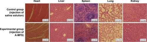 Figure 9 Histology of heart, liver, spleen, lung, and kidney in the two groups, following injection of saline solution and A-MFS, respectively.Note: No obvious differences were seen in the control and experimental groups.Abbreviation: A-MFS, Fe3O4@SiO2 modified with anti-mesothelin antibody.