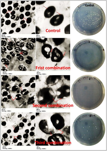 Figure 6. (A) Effect of different combinations of cefoxitin and CuO-NPs on S. aureus SA-325 under TEM. (The figures on the left with a magnification of 30 K while that on the right with a power of 80 K). (B) Growth of S. aureus strain SA-325 after treated with combinations 1, 2, 3, and control.