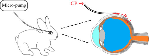 Figure 1 Schematic of sub-Tenon micro-perfusion of CP in rabbit. CP was released via sub-Tenon micro-perfusion system consisting of a catheter, a micro-needle, and a micro-pump, then it permeated into the vitreous from the scleral surface.