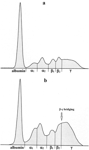 Figure 1. (a,b) Representative electrophoretograms in cows: (a) healthy cow, (b) MAP-positive cow with chronic diarrhoea.