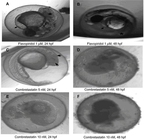 Figure S2 Gross morphological changes in the zebrafish larvae following non-VEGFR angiogenesis inhibitors at 96 hours post fertilization.Notes: (A and B) Treatment with non-VEGFR inhibitors like flavopiridol was associated with development of pericardial edema (arrows) and widespread tissue necrosis (*) at LOEC concentrations. (C–F) Treatment with combretastatin was associated with dose- and time-dependent coagulation of embryos at concentrations as low as 5–10 nM (arrows).Abbreviations: VEGFR, vascular endothelial growth factor receptor; LOEC, lowest observed effect concentration; hpf, hours post-fertilization.