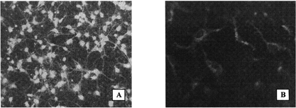 Figure 2 Fluorescence micrographs of the cultured embryonal rat brain astrocytes (original magnification 200 ×). (A) Cells treated with D4 monoclonal anti-GFAP antibodies followed by goat antimouse antibodies labeled with fluorescein isothiocyanate. (B) Red fluorescence of the astrocytes incubated with Dil-labeled PEGylated immunoliposomes coupled with the D4 antibodies.