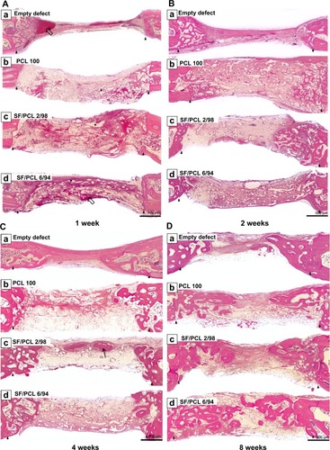 Figure 11 Hematoxylin and eosin-stained histological sections after implantation at low magnification.Notes: Representative histological sections show the cross section of calvarial defects with native bone at the edges after (A) 1 week, (B) 2 weeks, (C) 4 weeks, and (D) 8 weeks. Arrowheads indicate edges of the calvarial defects. Empty arrows indicate blood clots. Thin black arrow indicates new bone. Asterisks indicate remaining scaffolds. Original magnification 50×.Abbreviations: PCL, poly(ε-caprolactone); SF, silk fibroin.