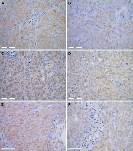 Figure 6 Histopathologic comparisons between radiotherapy and control groups using slides at 400× magnification. Scale bar: 50 μm. (A) 24 h cyclin D1 expression in the control group; (B) 24 h cyclin D1 expression in the radiotherapy group; (C) 24 h survivin expression in the control group; (D) 24 h suivivin expression in the radiotherapy group; (E) 24 h Ki67 expression in the control group; and (F) 24 h Ki67 expression in the radiotherapy group.