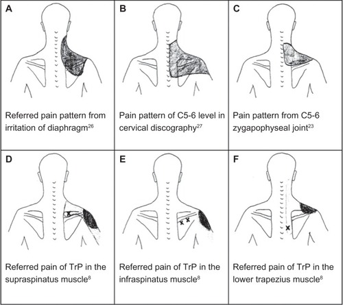 Figure 4 Several possible etiologies in the diagnosis of chronic shoulder pain.