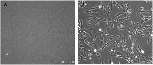 Figure 1. P3 generation of BMSCs observed by light microscopy at low (A) and high (B) magnification. Cell morphology was consistent with the characteristics of BMSCs.