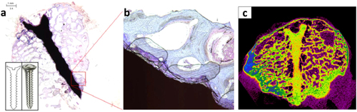 Figure 1. (a) Histology of extruded Mg5-wt%Ca-1wt%Zn alloy bone screw in femoral condyle (b) magnified view of cross section of the bone screw, (c) micro-computed tomography of the bone screw at 24 weeks after operation. Reprinted by permission from Macmillan Publishers Ltd: [Citation22], copyright 2013.