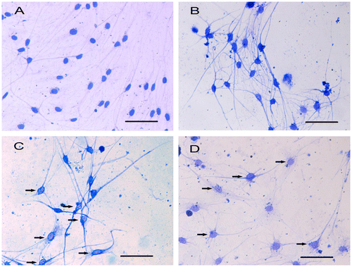 Fig. 4. CBB staining shows different distribution of cytoskeleton in cultured DRG neurons.Notes: The distribution of cytoskeleton is nearly normal and there are no significant marginalized gathered cytoskeleton in DRG neurons in control group (A) and 0.3 MPa group (B). However, in 0.5 MPa group (C) and 0.7 MPa group (D), the distribution of cytoskeleton changed obviously, with some nonuniformed distribution of cytoskeleton. Black arrows show the marginalized gathered cytoskeleton in mechanical-treated cells. Scale bar, 50 μm.