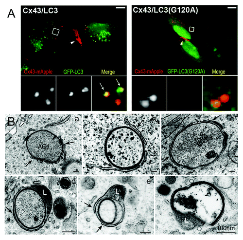 Figure 3. Fluorescence and ultrastructural evidence for autophagic AGJ vesicle degradation. (A) HeLa cells were cotransfected with Cx43-mApple and the mammalian autophagy marker protein GFP-LC3 (panel 1), or the activation-deficient LC3-mutant GFP-LC3(G120A) (panel 2). In cells, a fraction of cytoplasmic LC3 (LC3-I) is conjugated to phagophore-membranes (LC3-II) that localizes to autophagosomes; LC3(G120A) cannot be conjugated and remains cytoplasmic. Representative merged fluorescence images acquired 24 h post transfections are shown. Individual and merged fluorescence signals of the boxed areas are shown below at higher magnification. Robust colocalization of cytoplasmic AGJ vesicles present in Cx43-mApple expressing cells (red puncta) with GFP-LC3-II (green puncta) was observed in GFP-LC3 expressing cells, but not in GFP-LC3(G120A) expressing cells. Representative colocalizing AGJ vesicles are marked with arrows; GJs are marked with arrowheads. Bars = 10 μm. (B) Multiple stages characteristic of progressive autophagosome formation and maturation that formed around AGJ vesicles were revealed by ultrastructural analyses of Cx43-GFP expressing HeLa cell preparations. Double-membrane cisternae (phagophores, marked with arrows) progressively encircled AGJ vesicles (panels a–c), coalesced into phagophores (panels c–e) and fused with lysosomes (L, panels d and e), resulting in AGJ degradation inside the phagosome (panel f).