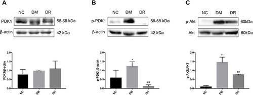Figure 4 Levels of PDK1 and AKT in livers of all groups. (A) The level of total PDK1 in the liver was detected by Western blot. (B) The level of p-PDK1 in the liver was detected by Western blot. (C) The level of p-AKT in the liver was detected by Western blot. Experiments were performed at least thrice with similar results. *P < 0.05, **P < 0.01 vs NC group; ##P < 0.01 vs DM group.