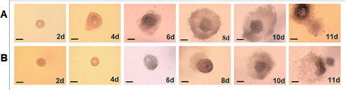 Figure 3. Effect of rhBMP-6 on the morphology of preantral follicles in vitro. Follicles under normal development (A) or abnormal development (B), on day 2, 4, 6, 8, 10 and 11. Bar = 100 μm.