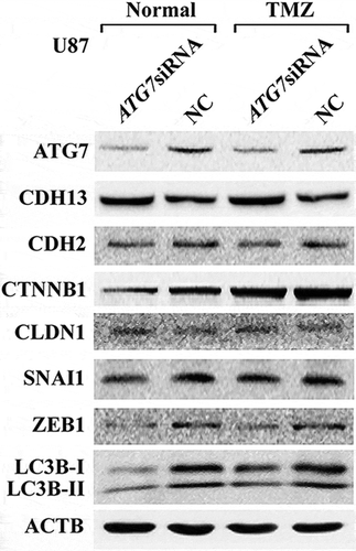 Figure 4D: Western blotting was used to detect the expression of autophagy- and EMT-related proteins in U87 cells transiently transfected with ATG7 siRNA in normal medium or in the presence of TMZ.