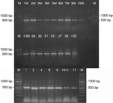 Figure 5. PCR-amplification of streptomycetes DNA for the genes involved in the synthesis of PKS-II. M- DNA Ladder (Fermentas); 155 - S. hygroscopicus 155; the number of each lane corresponds to the numbers of the strains.