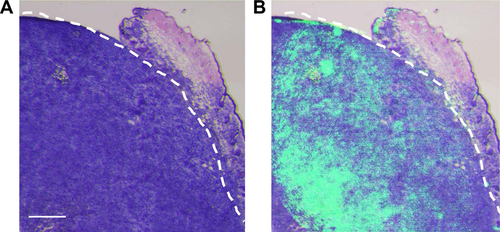 Figure S4 (A) Histological analysis of the tumor specimen encompassed the border regions between tumor and normal tissues from the resected tissues. (B) Overlay of PD-1 NIRF image and H&E staining of the specimen, showing consistent tumor margin at the microscopic level. Scale bar =500 µm.Abbreviation: NIRF, near-infrared fluorescence.