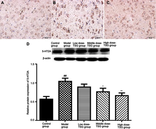 Figure 6 Effects of TSG on 5-hydroxytryptamine receptor 2A (5-HT2A) expression in rats with cerebral ischemia/reperfusion injury. (A) Control group (the thalamic nucleus, ×40); (B) Model group (the thalamic nucleus, ×40); (C) TSG group (the thalamic nucleus, ×40). (D) Western blot analysis of 5-HT2A expression. Data are expressed as the mean ± standard deviation (n=3 per group); ##P<0.01 vs control group; *P<0.05, **P<0.01 vs model group.