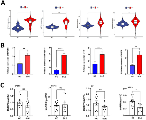 Figure 7 The m6A modification level and gene expression level of hub genes. (A) Violin plots illustrating the expression profiles of four hub genes. (B) Validation of the expression levels of four hub genes in SLE using RT-qPCR. (C) Verification of the m6A modification levels of four crucial genes in SLE through MeRIP-qPCR. (*p < 0.05, **p < 0.01, ***p < 0.001, **** p < 0.0001).