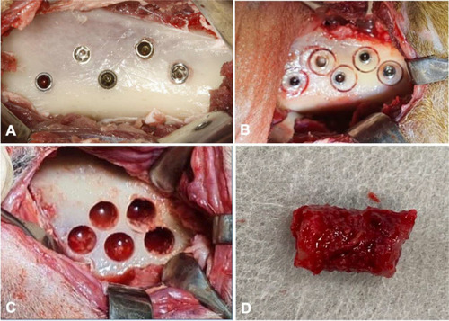 Figure 1 Surgical procedures for implant’s installation of the 5 implants. (A) Implants installed in the iliac crest with a minimum distance of 5 mm between each implant; (B) after 2 and 4 weeks, the implants were trephined with a trephine drill (internal diameter = 5 mm) to remove the bone block containing the implant; (C) bone defects after the removal of the bone blocks and (D) bone block trephined with implant inside.
