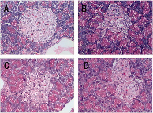 Figure 2. Effects of MDE on histopathological changes of pancreas in T2DM rat (×40, H&E staining). (A) control group, (B) untreated diabetic group, (C) MDE-treated group, (D) metformin-treated group.