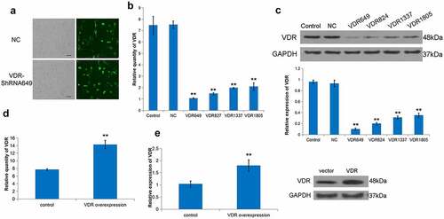 Figure 2. Effect of differential expression of VDR on the proliferation of LX-2 cells. (a) To evaluate the transfection rate of NC or VDR-shRNA, transfected LX-2 cells were shown through detecting GFP fluorescence. Scale bar, 50 μm. (b) and (c) The expression of VDR was detected by RT-qPCR and Western blot for multiplex VDR-shRNA screening. (d) and (e) Overexpression efficacy of VDR was validated in LX-2 cells by RT-qPCR and Western blot. (f) The effects of VDR overexpression or knockdown on the proliferation of LX-2 cells were detected by the CCK8 assay.