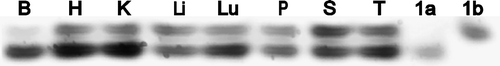 Figure 2.  Relative tissues expression of mENT1a and mENT1b. mRNA was isolated from the indicated mouse tissues (B, brain; H, heart; K, kidney; Li, liver; Lu, lung; P, pancreas; S, spleen; T, testis), and RT-PCR was performed using a primer pair that spanned the region that differed between the mENT1a and mENT1b splice variants (see Figure 1). mENT1a and mENT1b cloned into pcDNA3.1 were used as controls (1a, 1b). The PCR amplified products were separated by electrophoresis on a 5% polyacrylamide gel. This is a representative result from 2 independent tissue screens.