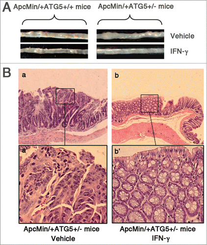 Figure 2. IFN-γ treatments effectively prevent intestinal adenomas in ApcMin/+ATG5+/− mice. (A) Representative images of intestinal tracts from ATG5 deficient ApcMin/+ mice after early treatment with IFN-γ. (B) Micrographs of hematoxylin and eosin stained colonic tumor sections. Histological analysis of intestinal adenomas in ApcMin/+ATG5+/− mice receiving vehicle revealed well-formed adenomas with severe dysplasia (a and a‘). Following early treatment with IFN-γ, adenomas of ApcMin/+ATG5+/− mice mostly exhibited hyperplastic morphology without obvious dysplasia in the polypoid area of mucosa of intestine (b and b’). Images a‘ and b’ (×200 magnification) are high magnification of insets in a and b (×40 magnification), respectively.
