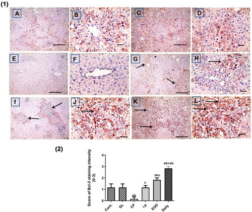 Figure 11 Hepatoprotective effect of Ganoderma lucidum on immunohistochemical expression of Bcl-2 in rat livers. (1) Representative microscopic pictures of liver sections immunostained using Bcl-2 antibody, showing mild positive staining score (1) in the control group (A and B), GL group (C and D). Negative staining score (0) in CP group (E and F), modulation of Bcl-2 as mild positive staining score (1) in i.p group (G, H), moderate positive staining score (2) in EOD group (I and J), and strong positive staining score (3) in daily-treated group (K and L). Black arrows point to positive staining. X: 100 bar 100 (A, C, E, G, I, and L) and X: 400 bar 50 (B, D, F, H, and J). IHC counterstained with Mayer’s hematoxylin. (2) Statistical analysis of IHC staining intensity scores in six experimental groups showing a significant increase in Bcl-2 in daily-treated group when compared with all groups. Different small alphabetical letters means significant when P< 0.05. aSignificant against control group; bsignificant against GL group; csignificant against CP group; dsignificant against i.p. group; esignificant against EOD group.