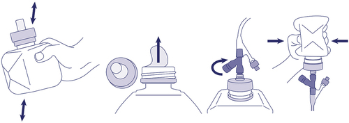 Figure 1. A graphical representation of SimpLink™ system. This new cap-based bolus feeding system is securely fixed onto Nestle Health Science’s SmartFlex™ collapsible semi-rigid bottles allowing secure and convenient administration of formula without the need for open administration through a syringe. SimpLink™ is compatible with ENFit feeding tubes, ensuring a tight connection.