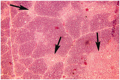 Figure 7. Thymus of broiler chick administered chlorpyrifos (20 mg/kg BW) at post-treatment Day 15. Representative photomicrograph shows hyper-cellularity along with immature monocytes in the medullary region, and necrosis of myoid cells (arrows). H&E stain. Magnification = 100×.