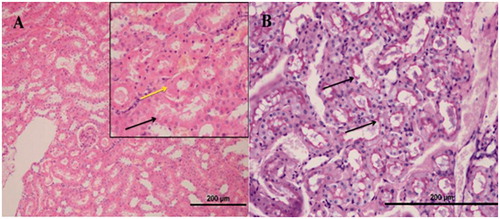 Figure 10. In the histopathological evaluation of the renal tissue of NRIR-100 group.