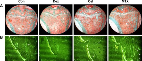 Figure 2 Representative micrographs of the proximal tibial metaphysis.