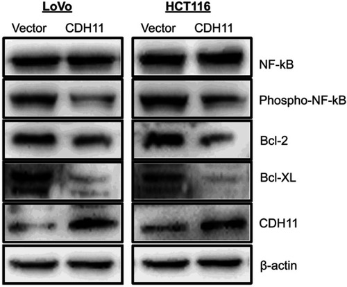 Figure 6 Overexpression of CDH11 antagonized NF-kB signaling pathway. Western blot was performed using antibodies against NF-kB, phospho-NF-kB and its downstream targets Bcl-2 and Bcl-XL; β-actin was used as a control.