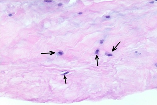Figure 1 The tenocyte nuclei are enlarged and rounded (arrows), and the cells show a small amount of visible cytoplasm.