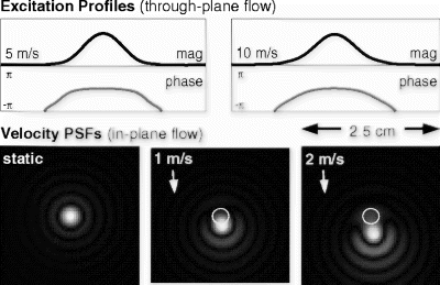 Figure 1. Illustration of the minimal flow distortion: (top) effective slice profiles based on high-speed through-plane flow, and (bottom) velocity point spread functions based on moderate in-plane flow.