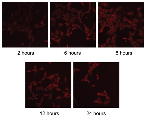 Figure 10 LSCM images showing mouse skin fibroblasts incubated with rhodamine B-labeled microemulsion for different incubation times.Abbreviation: LCSM, laser scanning confocal microscopy.