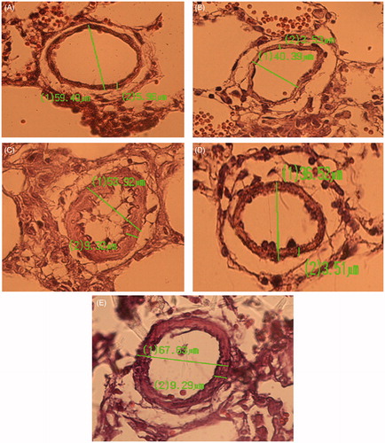 Figure 5. Arterioles of lung tissue of different animals group. (A) CTL group, (B) B200 group, (C) M group, (D) MB200 group, and (E) Msil group. Arterial wall thickness in monocrotaline group increased compared with other groups and two weeks consumption of barberry extract (200 mg/kg) attenuated this remodeling and its effect was stronger than 2 weeks consumption of sildenafil.