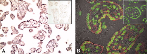 Figure 2. Localization of galectin-1 mRNA and protein in normal term placentas. (A) Galectin-1 mRNA hybridization signal was distinct in villous stromal cells and in the trophoblastic layers, especially in cytotrophoblasts. Inlet: there was no hybridization signal with antisense control (mRNA in situ hybridization, 20× magnification). (B) The syncytiotrophoblast apical membrane, villous capillary endothelial cells, and stromal cells were strongly immunopositive, while the villous stroma was weakly stained. Galectin-1 staining is shown in red, nuclei are in green. Inlet: there was only nuclear staining when applying isotype control primary antibody (immunofluorescence confocal microscopy, 40× magnification, fluorescence and differential interference contrast (DIC) combination images).