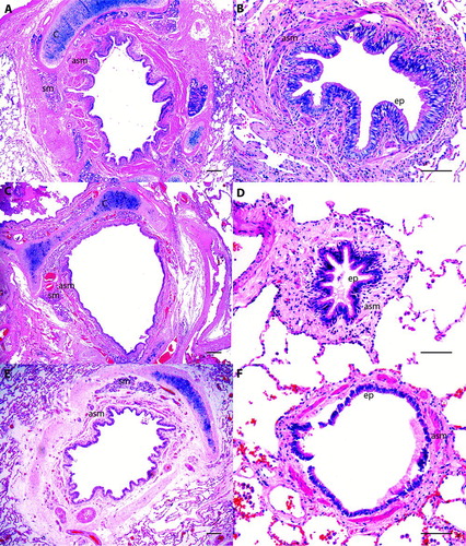 Figure 2.  Histological examples of large and small airways of patients with asthma (A, B), with COPD (C, D) and a control patient (E, F). Observe the prominent airway smooth muscle layer (asm) in large and small airways of the asthmatic patient. Cartilage = c, airway smooth muscle = asm, submucosal gland = sm, ep = epithelium. H&E staining. Scale bar = 250 μm in A, C and E. Scale bar = 100 μm in B, D and F.