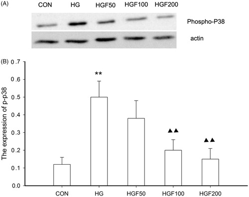 Figure 6. Effect of HGF on the expression of phospho-p38. (A) Bands of phospho-p38 for the different concentration of HGF. (B) Semi-quantitative analysis of proteins showed that HGF inhibited the expression of phospho-p38 in concentration-dependent manner. Data are expressed as the mean ± SEM of three independent experiments. **p < 0.01, compared with control group (CON). ▴p < 0.05, ▴▴p < 0.01 compared with high glucose groups (HG).