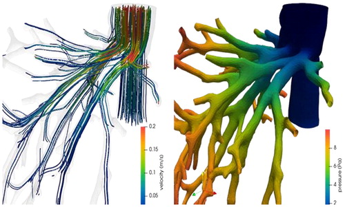 Figure 1. Velocity streamlines (left) and pressure map (right) in the hepatic veins connecting to the vena cava.